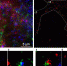 由科大超分辨率显微镜拍摄出来的影像（右上﹕缩放为小图1-6）比普通显微镜所拍摄的（左上）更为清晰，令研究团队首次发现ATM（蓝色）和ATR（红色）永不会于同一个突触小泡标记（绿色）上出现。 - 香港科技大学